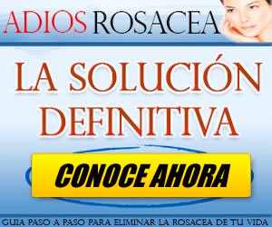 Adiós Rosácea