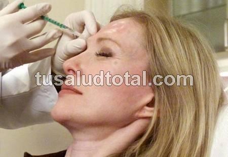 Cómo eliminar la flacidez de la cara con bótox