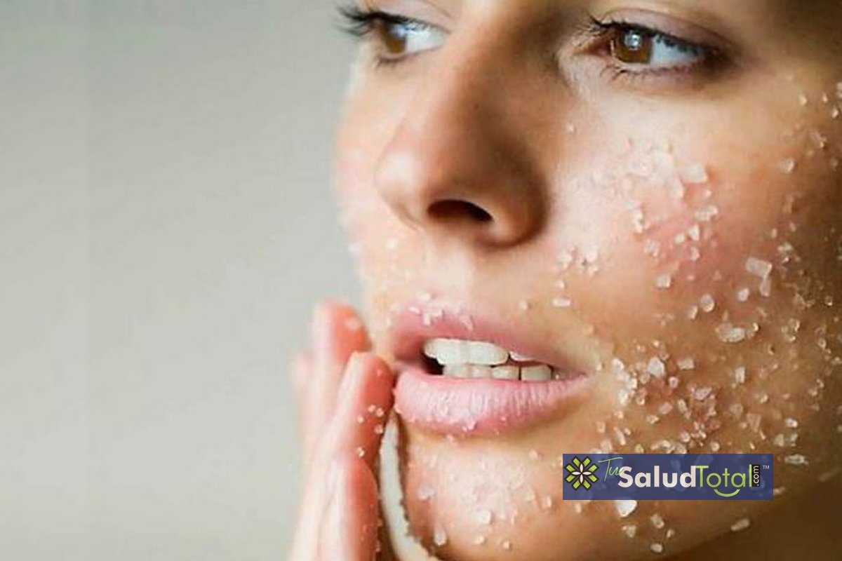Cómo combatir el acné en la cara de forma casera