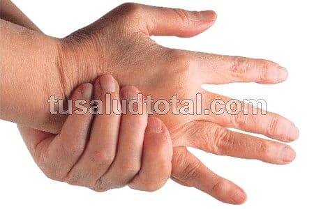 Ver cuáles son los síntomas de artritis en las manos