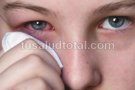 Persona con conjuntivitis limpiándose el ojo
