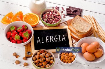 alergias alimentarias